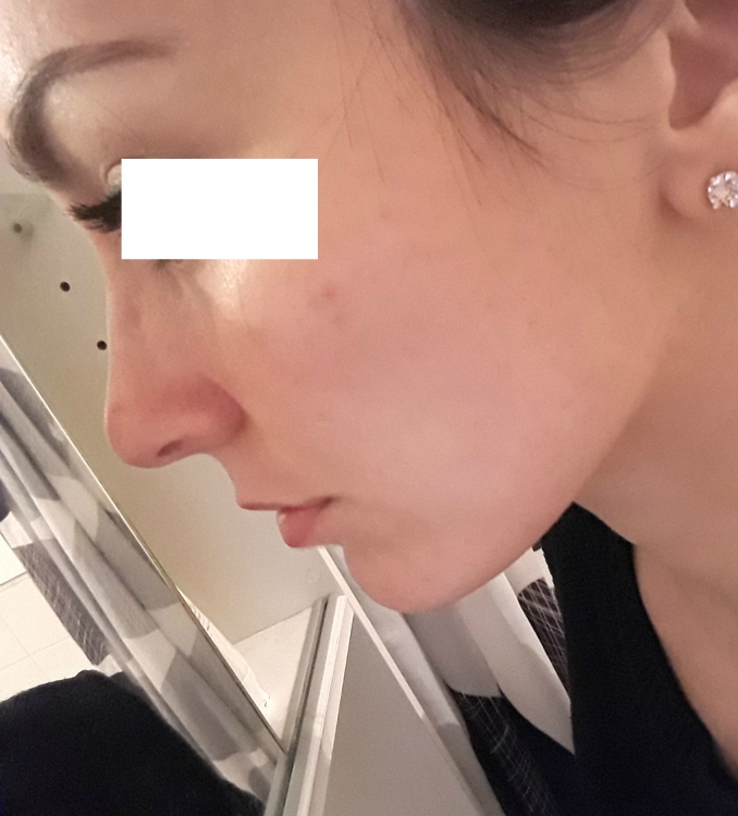20180413_11715.jpg