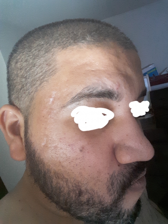 20180416_210306.thumb.jpg.654a71abc02a18f75206d31b64078dc3.jpg