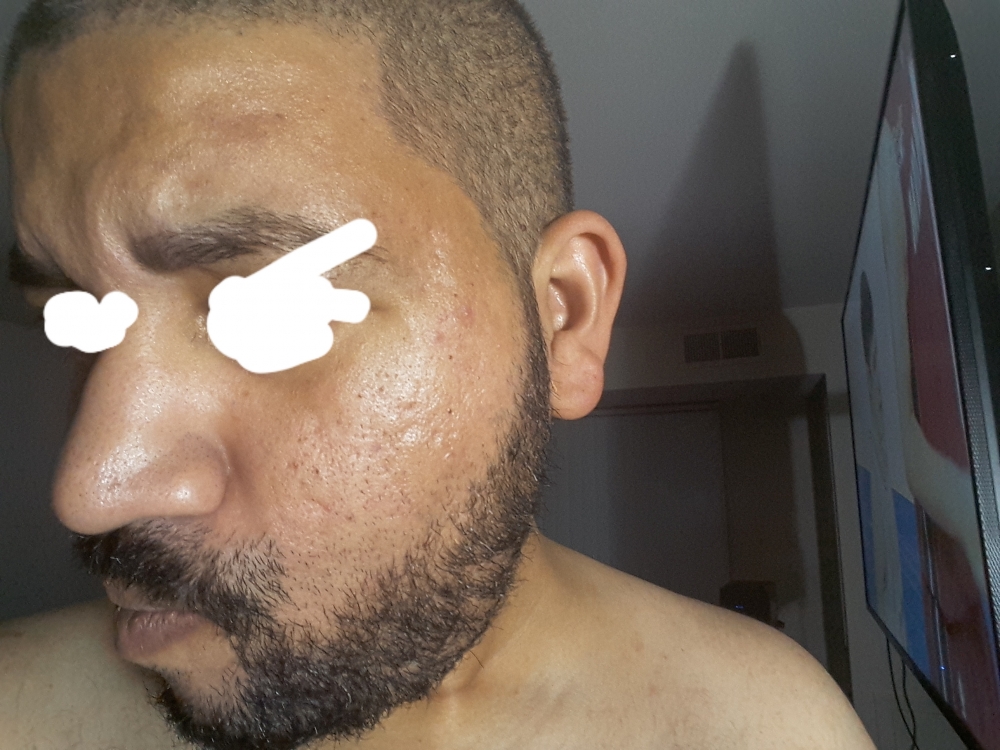 20180416_210440.thumb.jpg.ec563367174ada1070b1efcad0fbe3c8.jpg