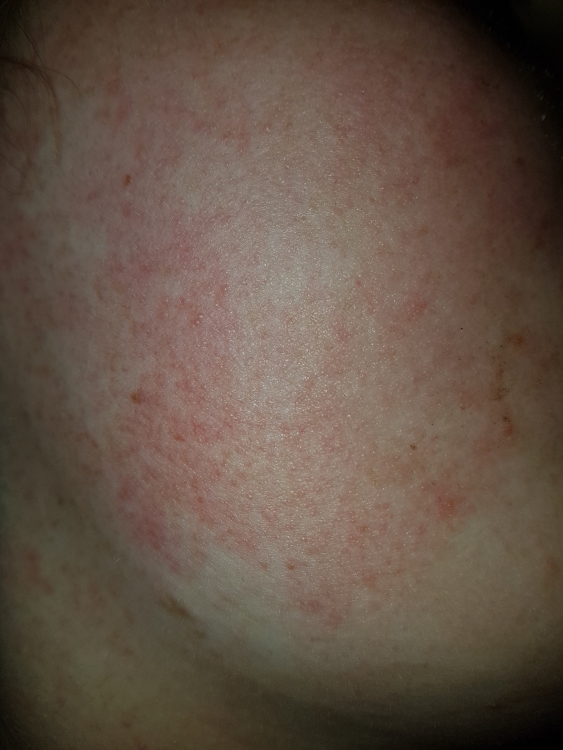 20180422_183440.jpg