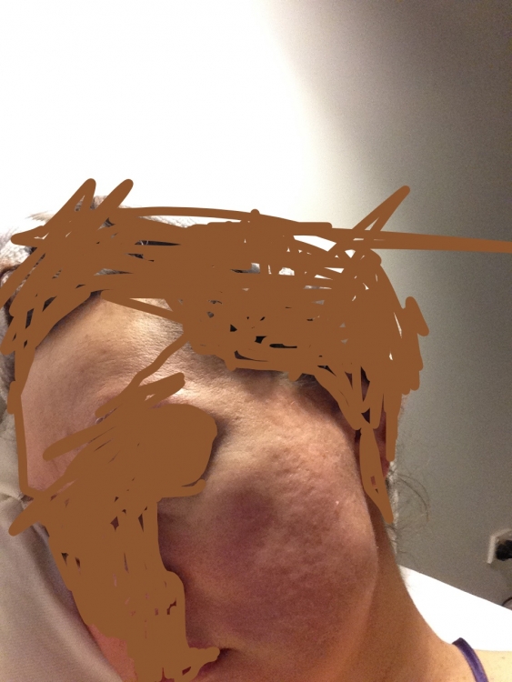 5ad1640054280_BEFORENO.1.thumb.jpg.1ddcbb6a205c48473fe29c080f3e0de9.jpg