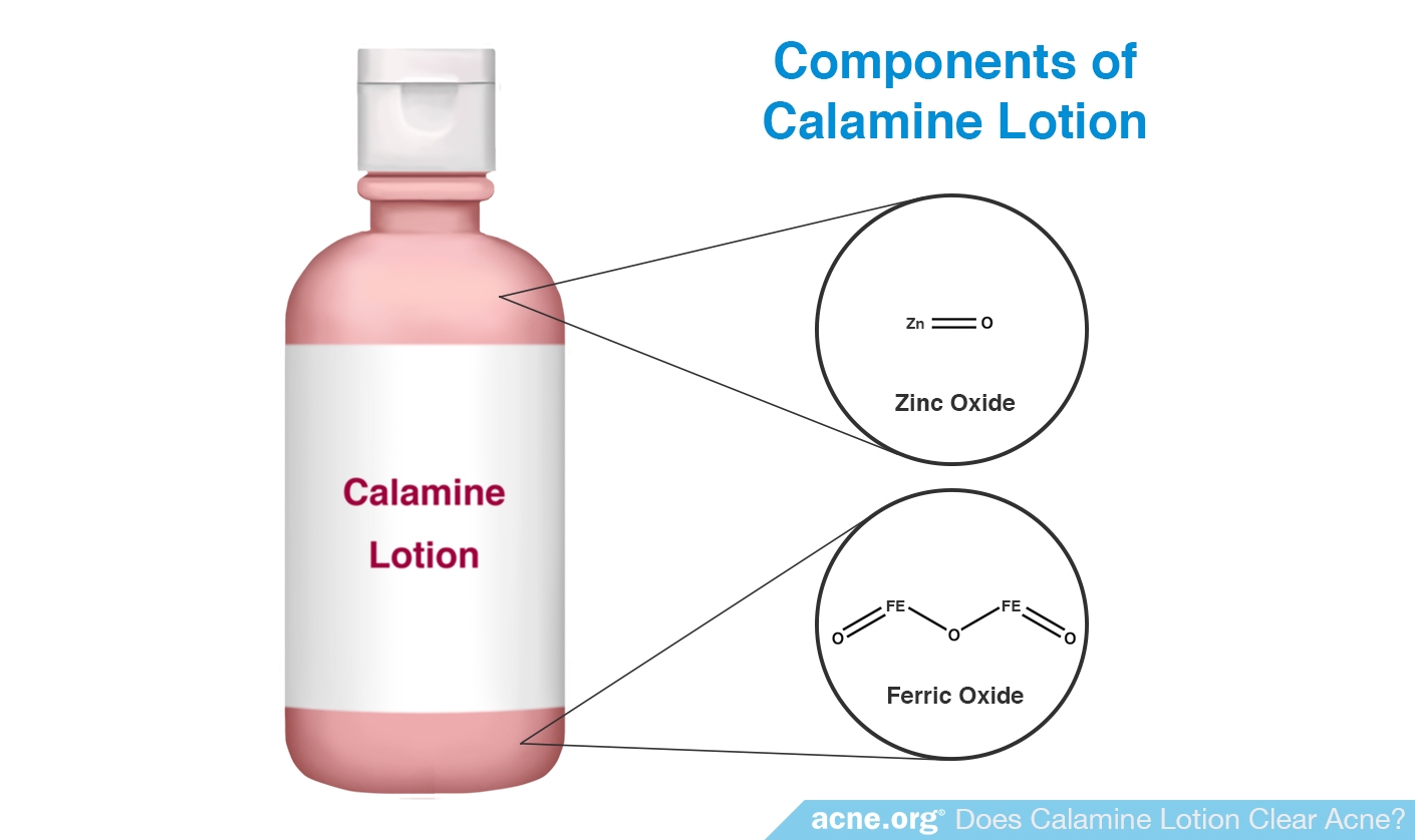 Components of Calamine Lotion