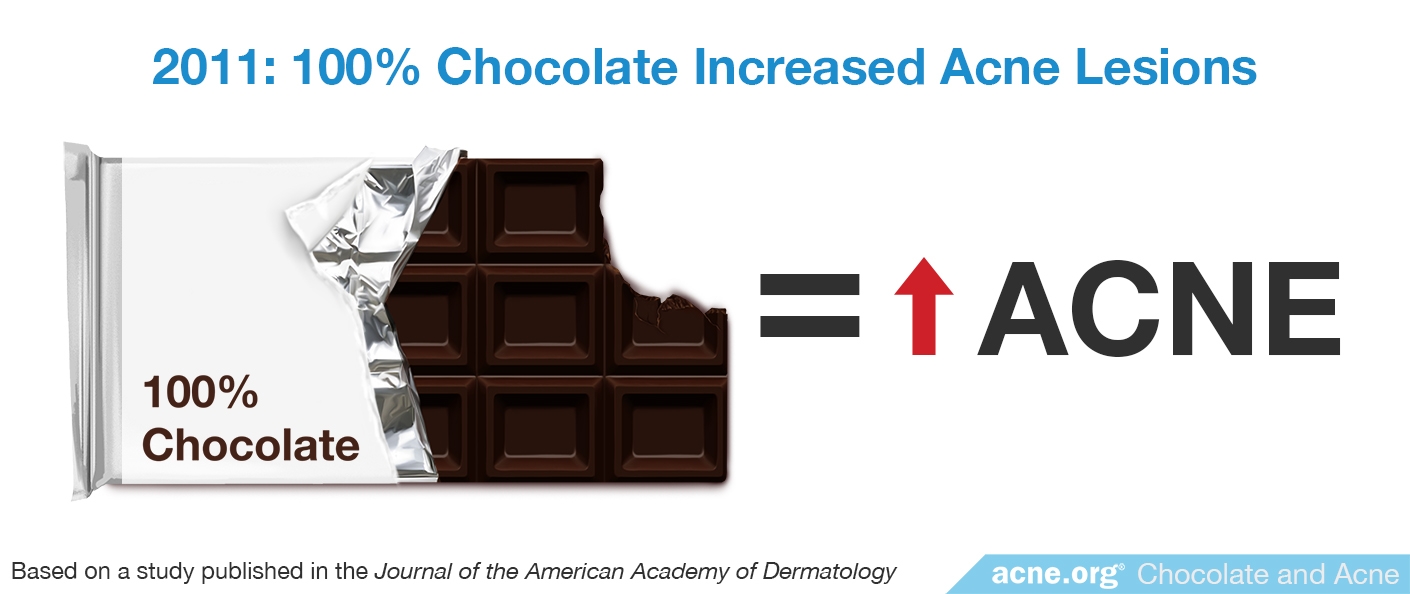2011 Study: 100% Chocolate Increased Acne Lesions