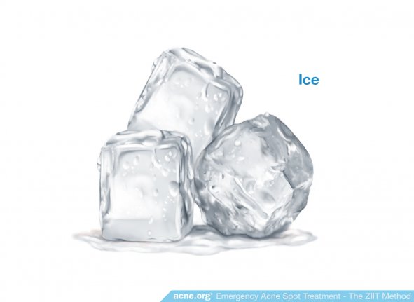 Ice