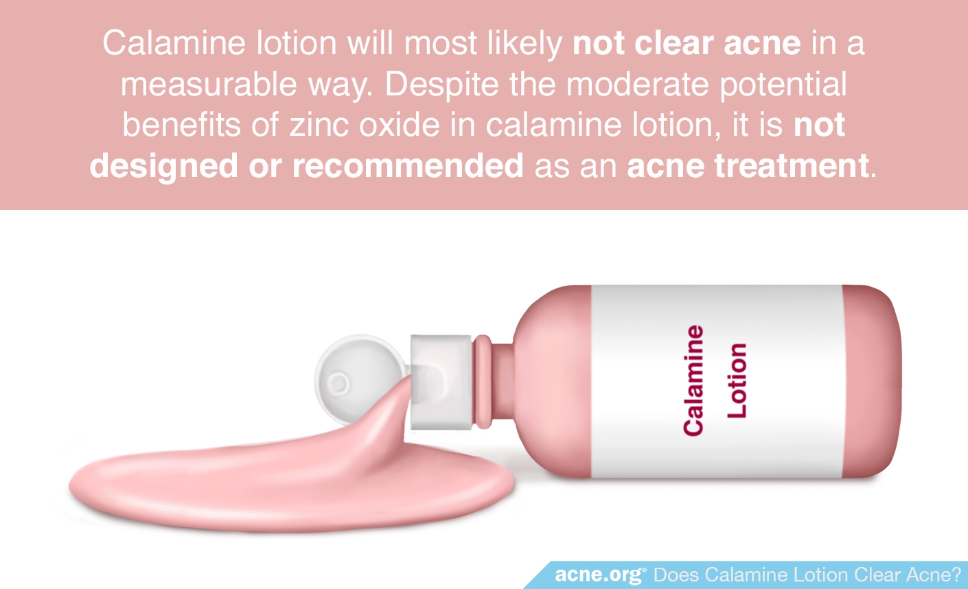 Does Calamine Lotion Clear Acne Acne