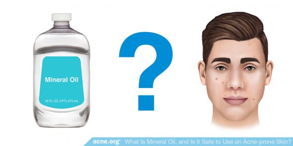 Mineral Oil for Acne Treatment?