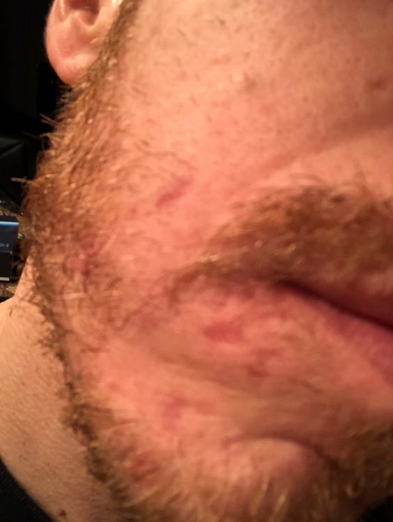 image1.thumb.jpeg.bcac0d02f0e76bf40f83a02650d6fe12.jpeg