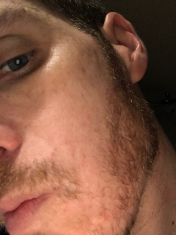 image2.thumb.jpeg.d4facca44713230a87861a81d64d52c7.jpeg