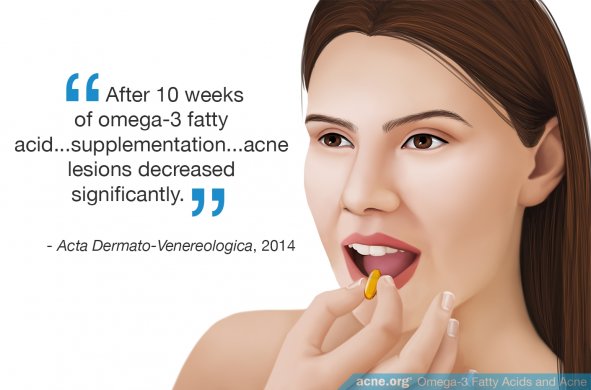 Omega-3 Fatty Acids and Acne