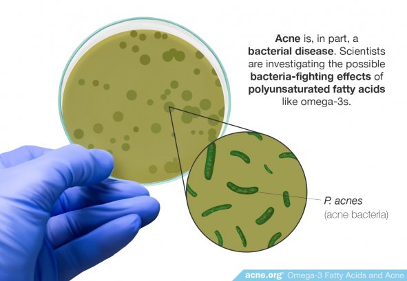 Scientists Are Investigating the Possible Bacteria-Fighting Effects of Omega-3 Fatty Acids