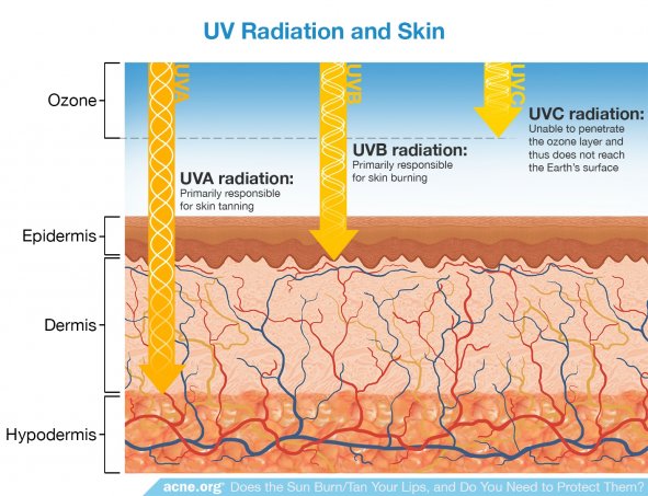 UV Radiation and Skin