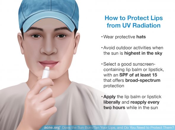 How to Protect Lips from UV Radiation