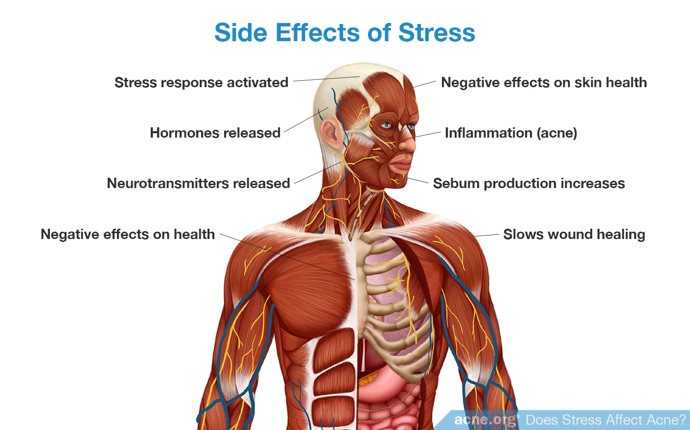 Side Effects of Stress