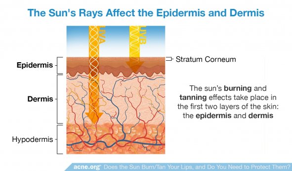 The Sun's Rays Affect the Epidermis and Dermis