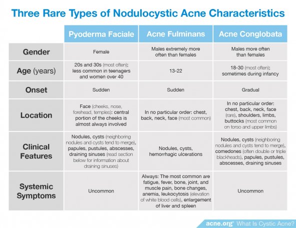 Three Rare Types of Nodulocystic Acne Characteristics