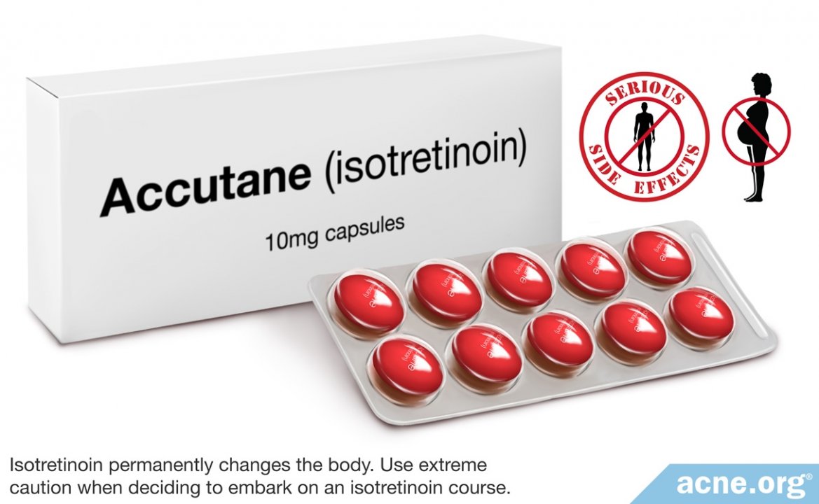 Accutane (Isotretinoin)