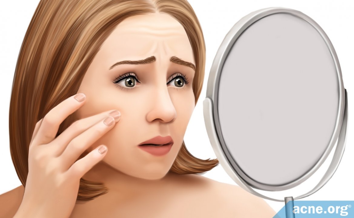 Acne Dysmorphia - Acne.org