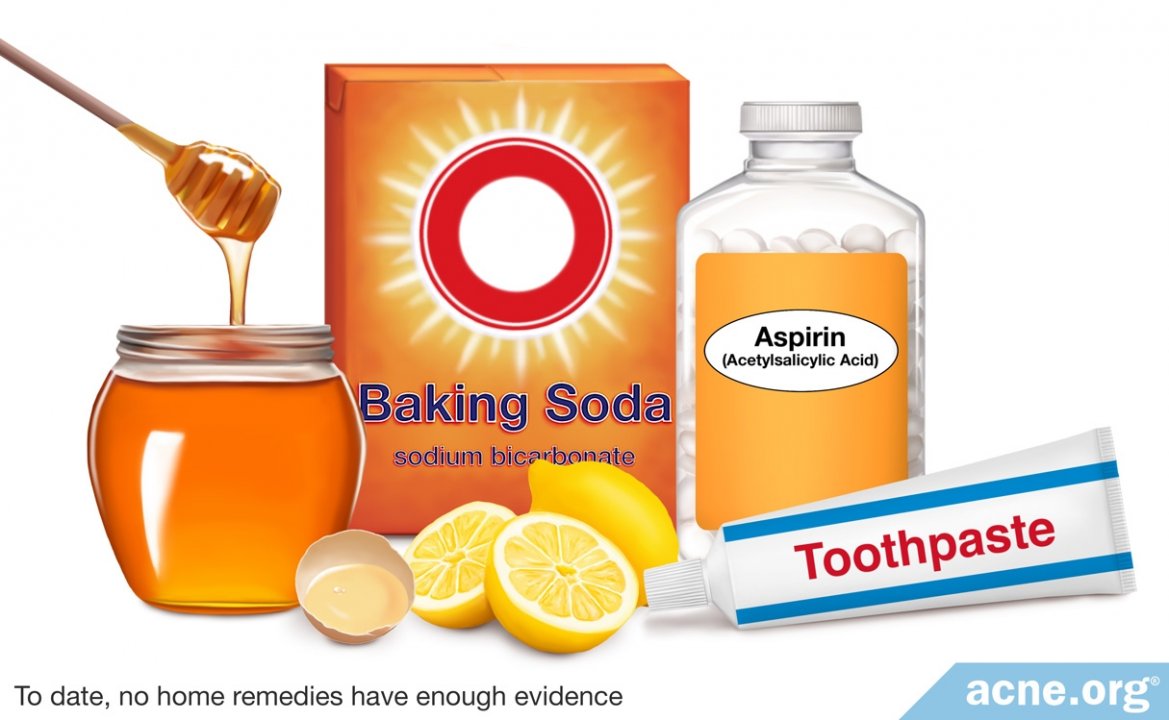 Acne Home Remedies