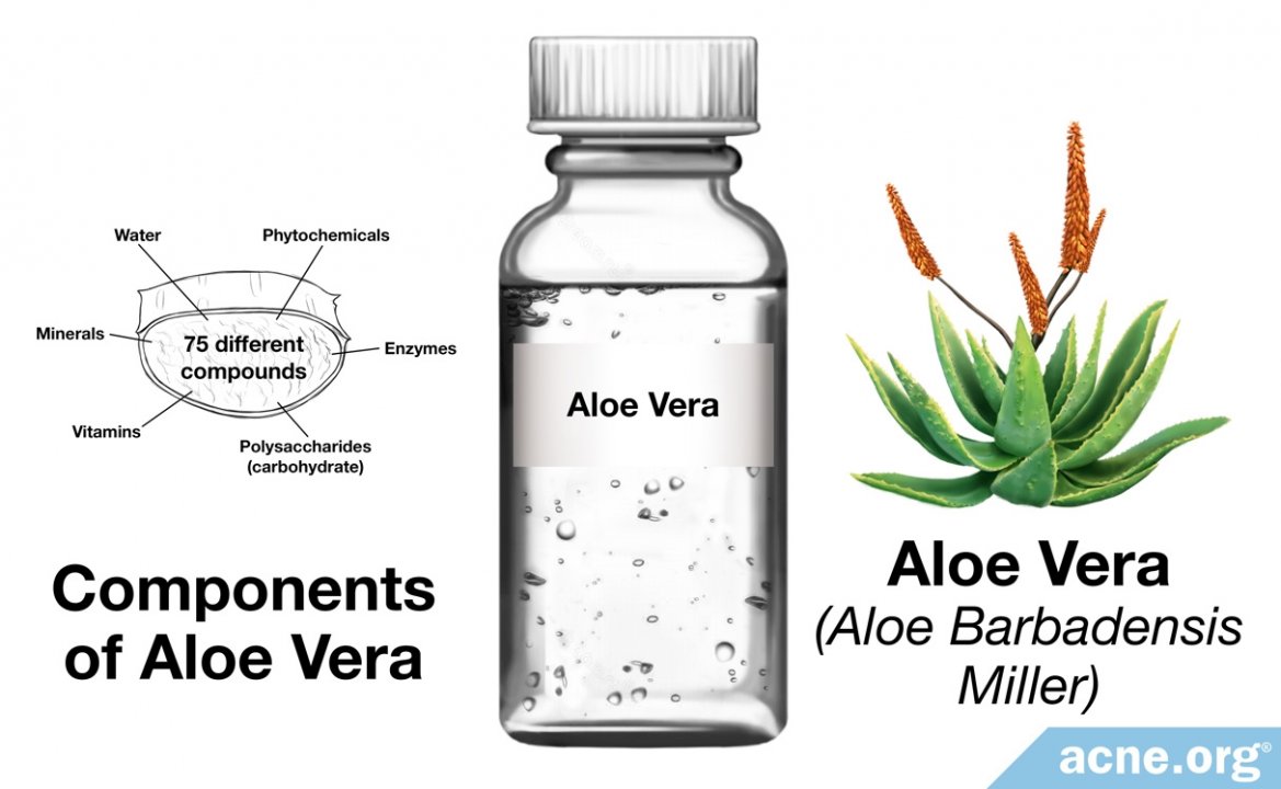 Can Aloe Help Acne?