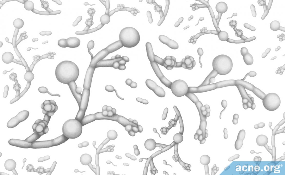 Can Candida Cause Acne?
