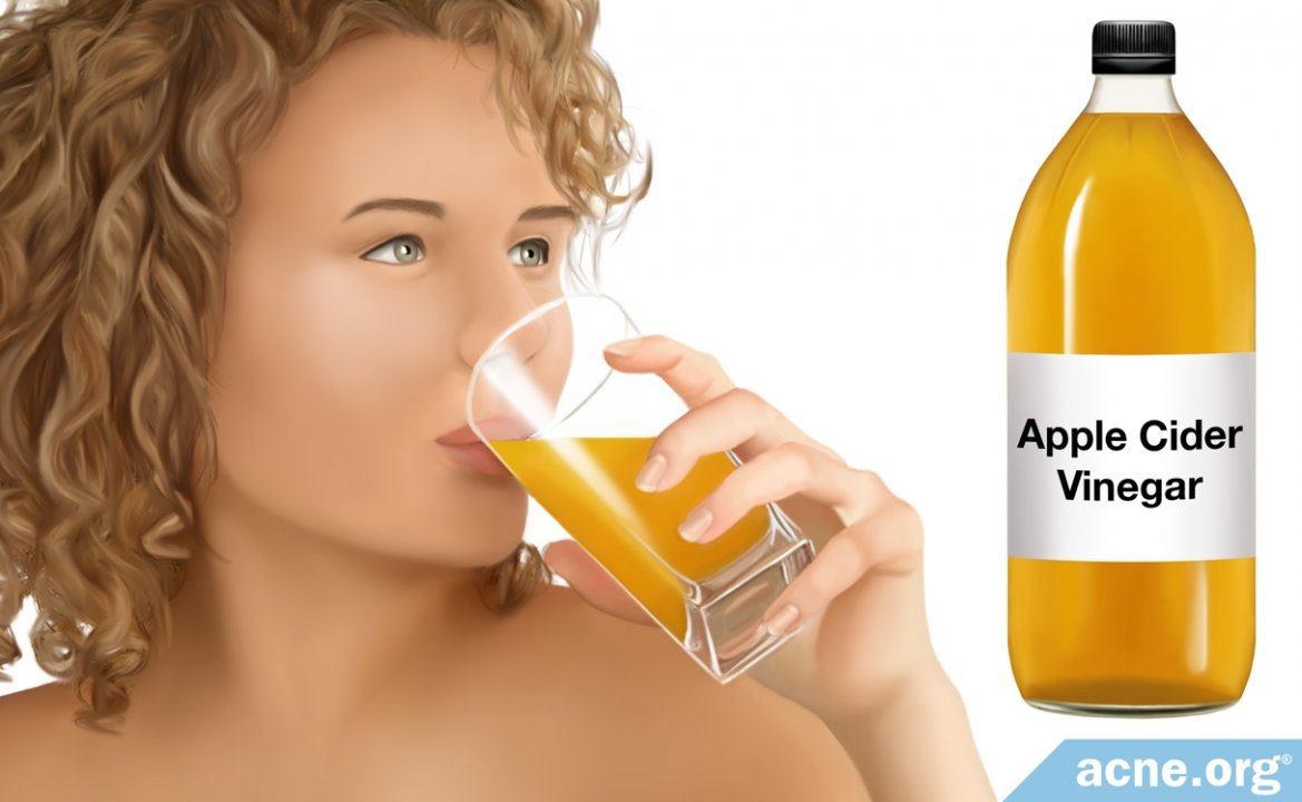 Can Drinking Apple Cider Vinegar Help with Acne?