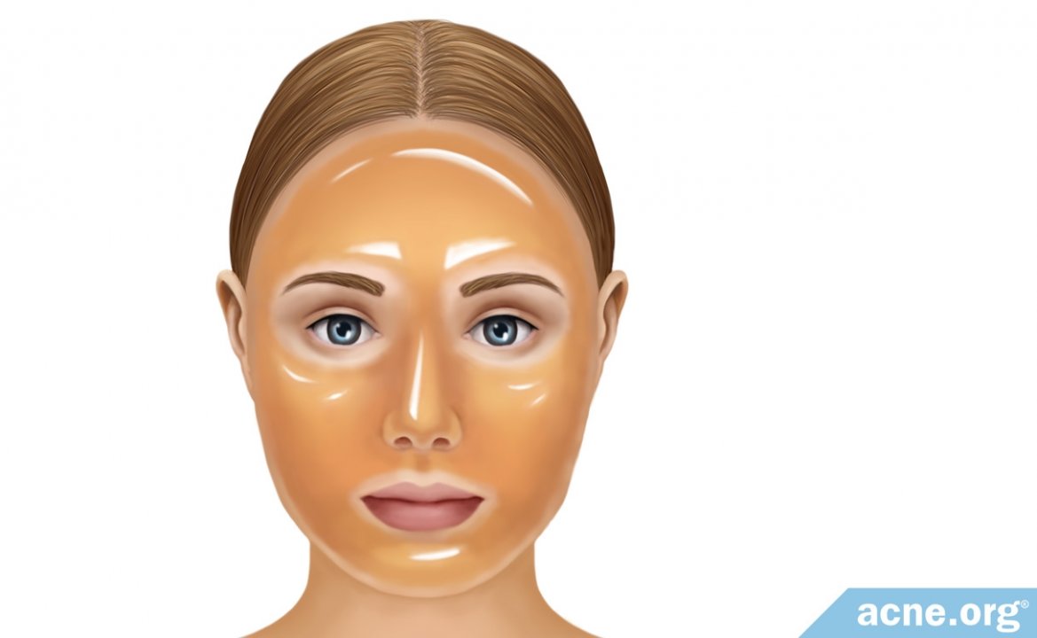 Can Honey Masks Help Clear Acne?