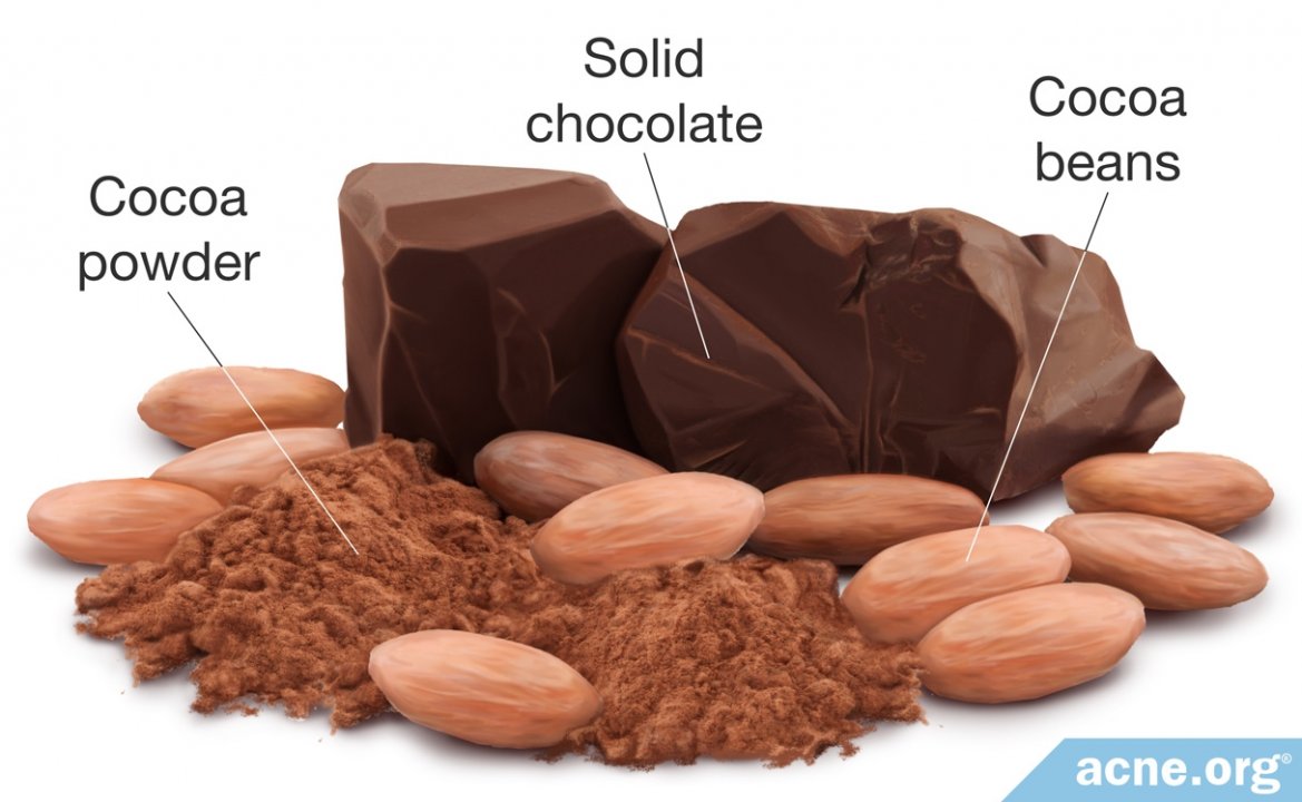 Chocolate and Acne