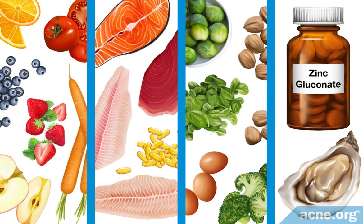 Diet and Acne