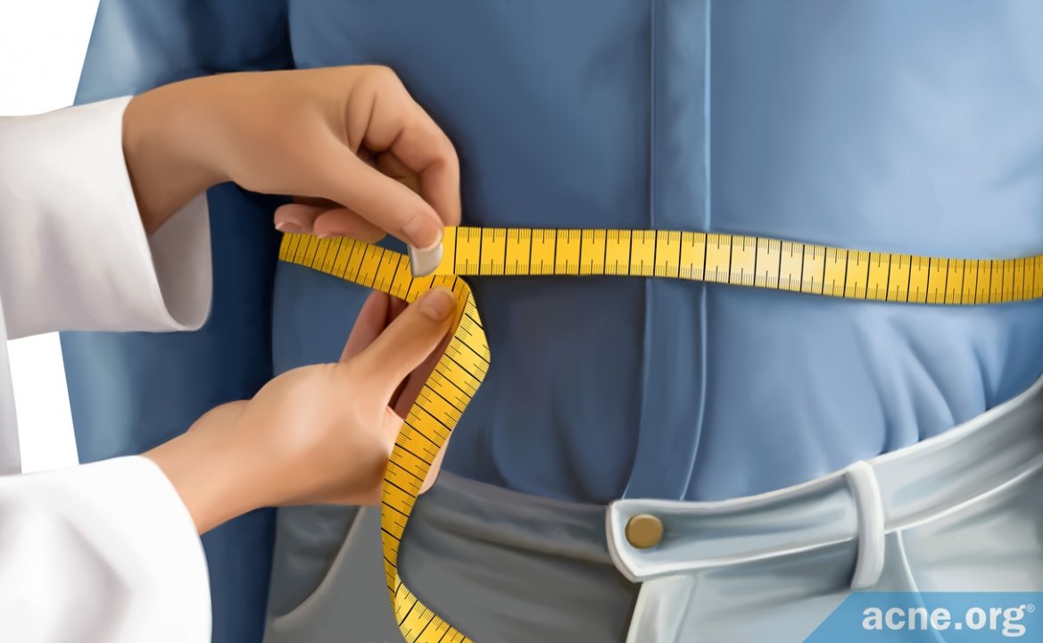 Does Being Overweight or Obese Make You More Likely to Develop Acne or to Have More Severe Acne?