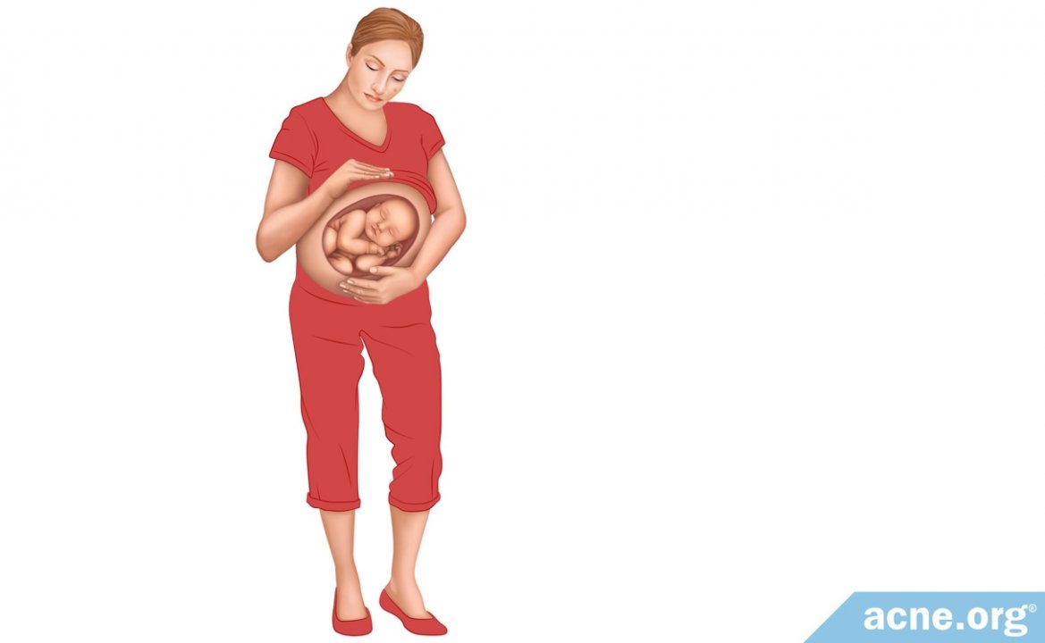 Does Pregnancy Cause Acne?