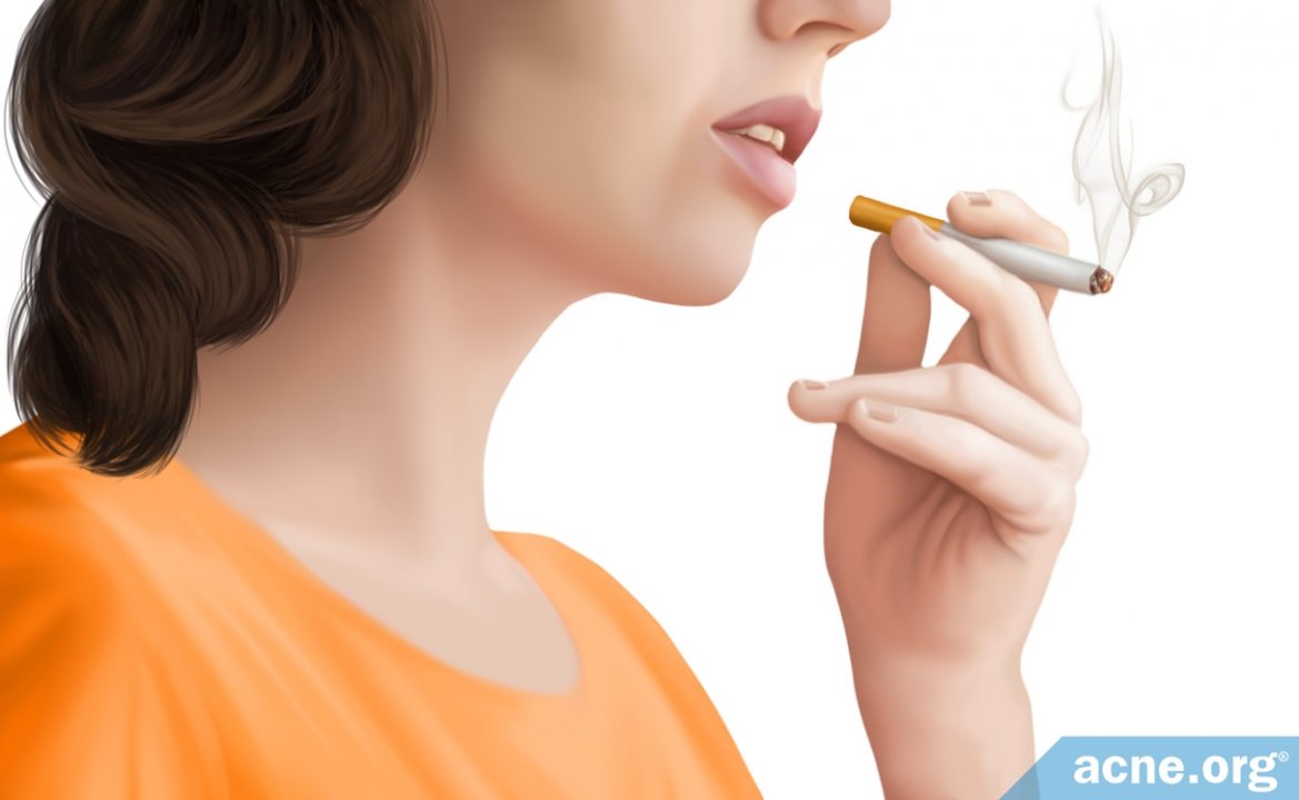 Does Smoking Cigarettes Cause Acne?
