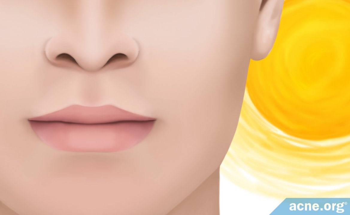 Does the Sun Burn/Tan Your Lips, and Do You Need to Protect Them?
