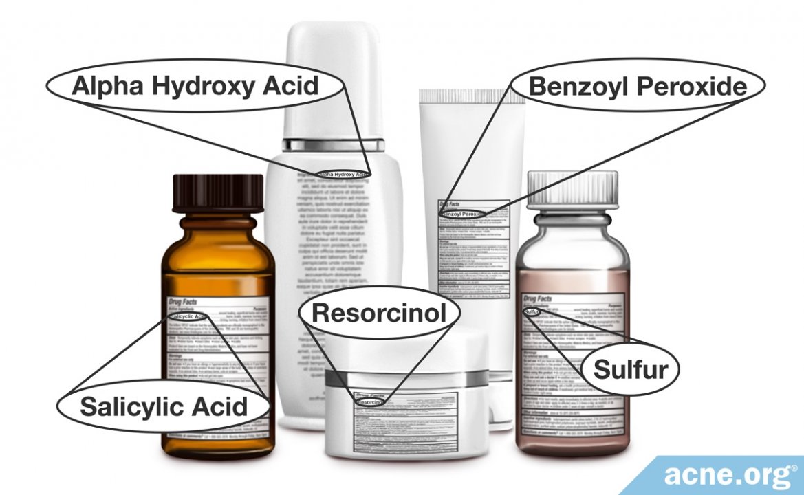 Over-the-Counter Treatment Ingredients for Acne