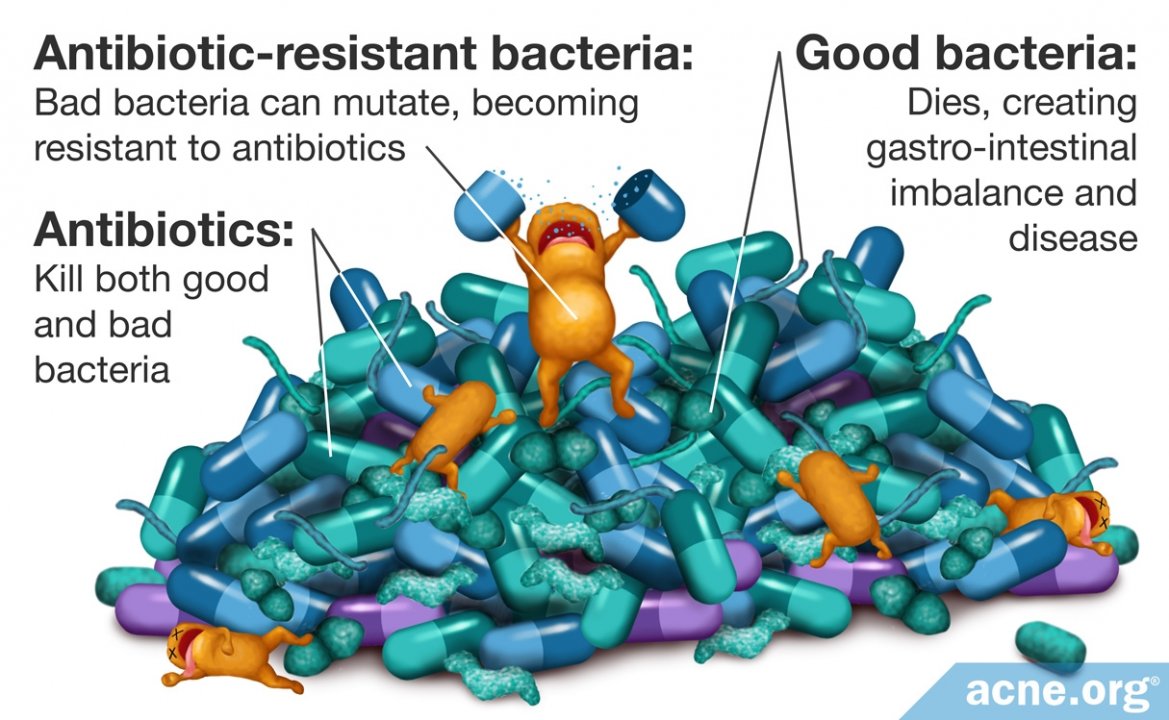 The Dangers and Ineffectiveness of Antibiotics for Acne