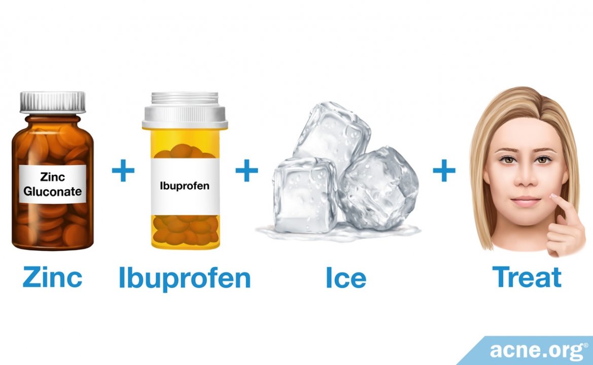 The ZIIT Method (Acne Spot Treatment) - Acne.org