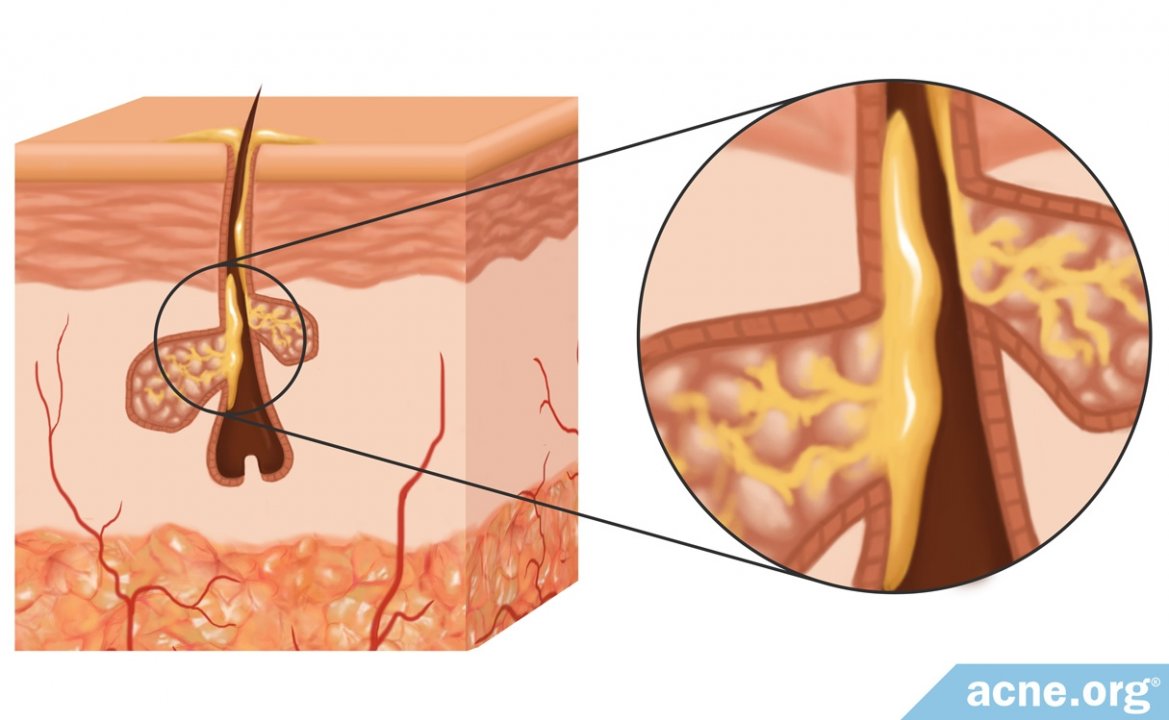 What Is Sebum and What Is Its Purpose?