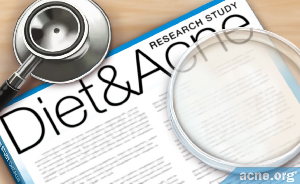 Why Is Researching “Diet and Acne” Difficult?