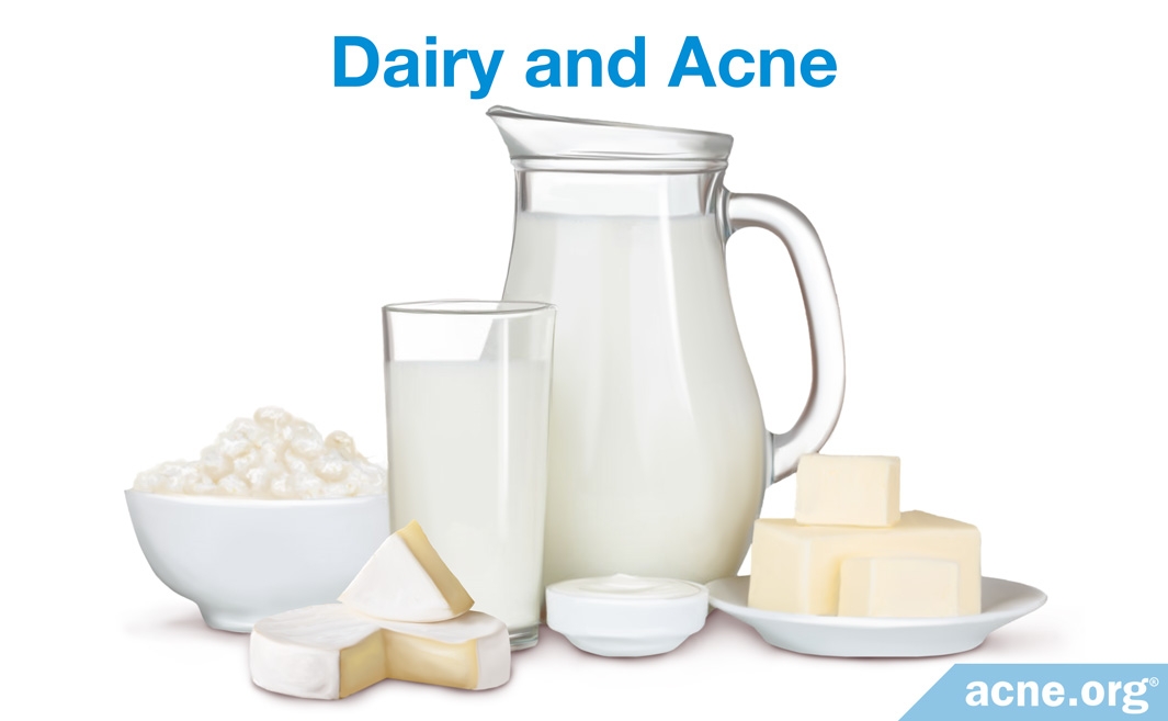 Diet and Acne: The Full Story - Acne.org