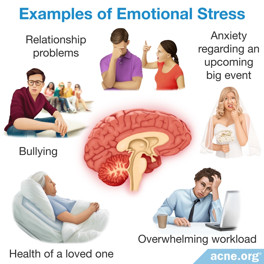 Emotional Stress: How Chronic Emotional Stress Can Ruin Your Health - FOOD  MATTERS®