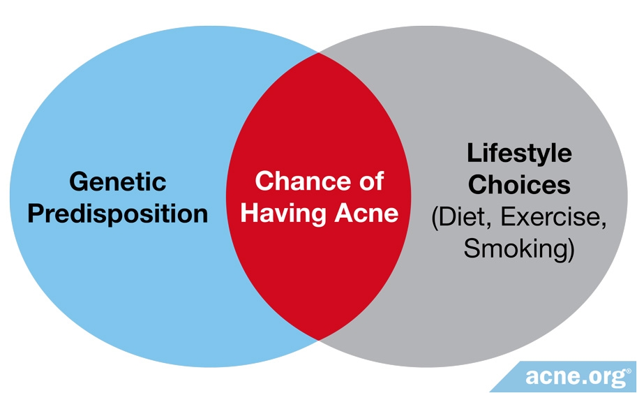 Genetic Predisposition and Lifestyle Choices Influence Acne Development