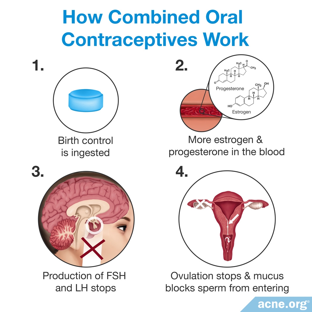 Men Say They're Not Willing To Put Up With Birth Control Side Effects :  Shots - Health News : NPR