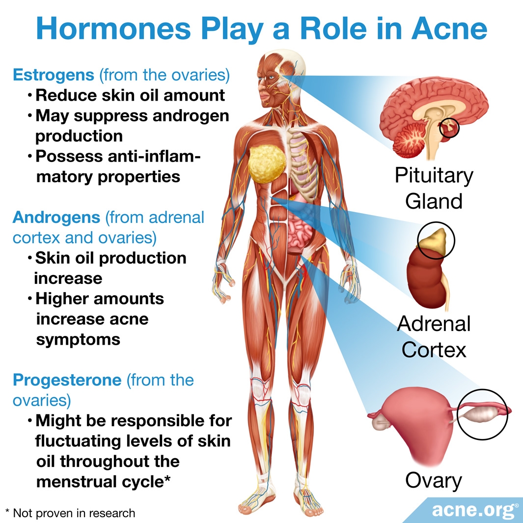 Premenstrual Acne - Acne.org