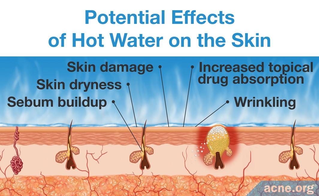 Is Drinking Hot Water Bad For Your Skin