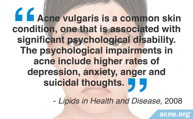 Acne vulgaris is associated with significant psychological disability