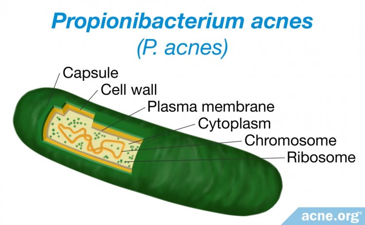 Propionibacterium acnes (P. acnes)