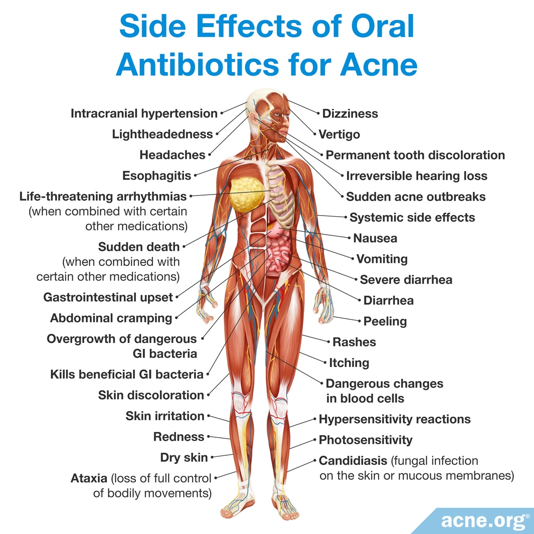 can-i-take-oral-antibiotics-while-on-the-birth-control-pill-acne