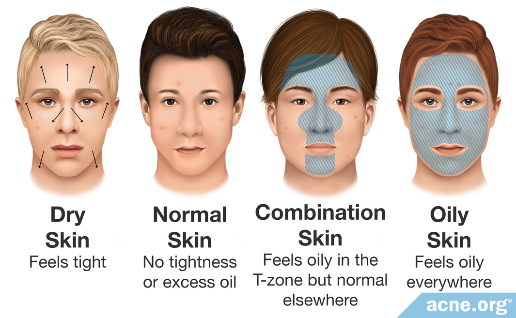 Dry skin перевод. Зе нормал фейс. Bad Skin Types.