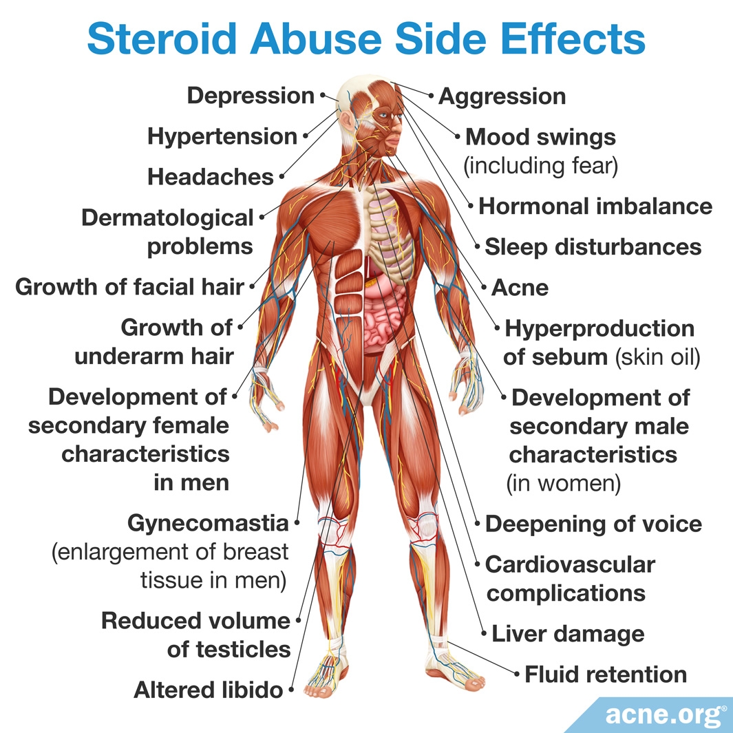 Do Anabolic Steroids Cause Acne? - Acne.org