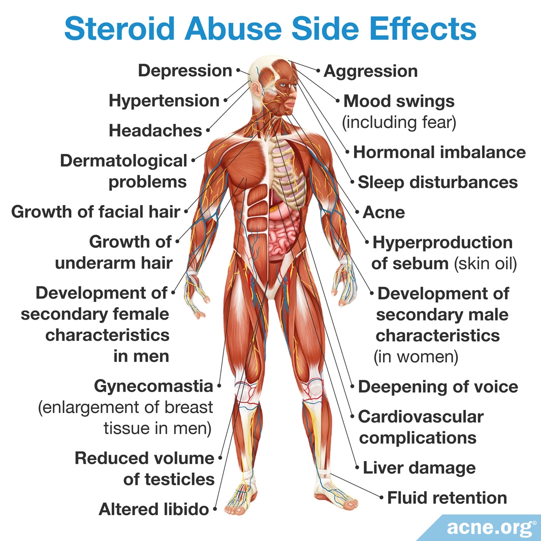 utilisation-des-st-ro-des-anabolisants-dans-le-bodybuilding-et-effets