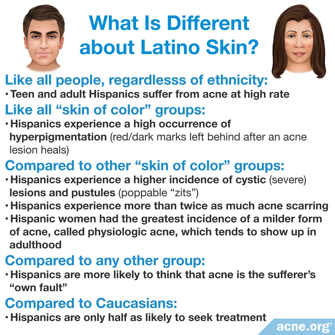 What Is Different about Latino Skin?
